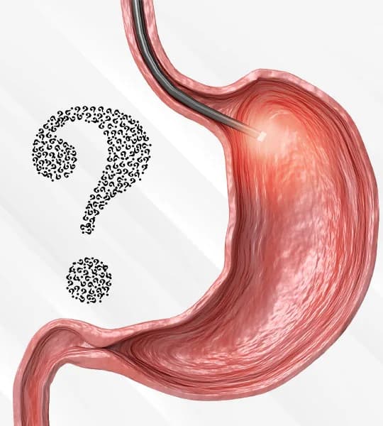 Gastric Botox